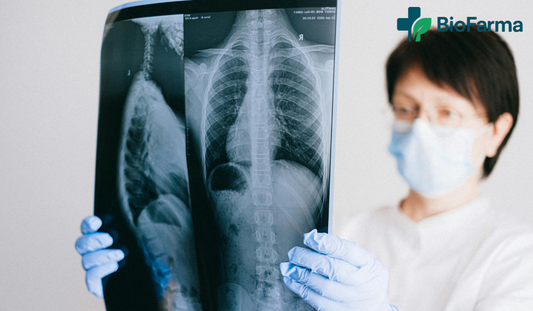 Cáncer de pulmón: todo lo que debes de saber